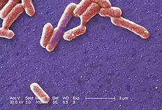 Escherichia coli (bacteria)